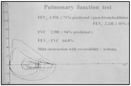 Image of Pulmonary Function Test